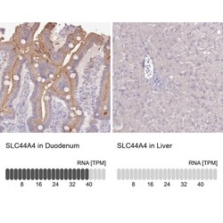 SLC44A4 Antibody, Novus Biologicals:Antibodies:Primary Antibodies